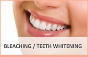 Cleaning Bleaching and Teeth Whitening Dental Clinic Mumbai