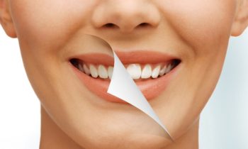 Best cosmetic Dental Clinic Mumbai-India