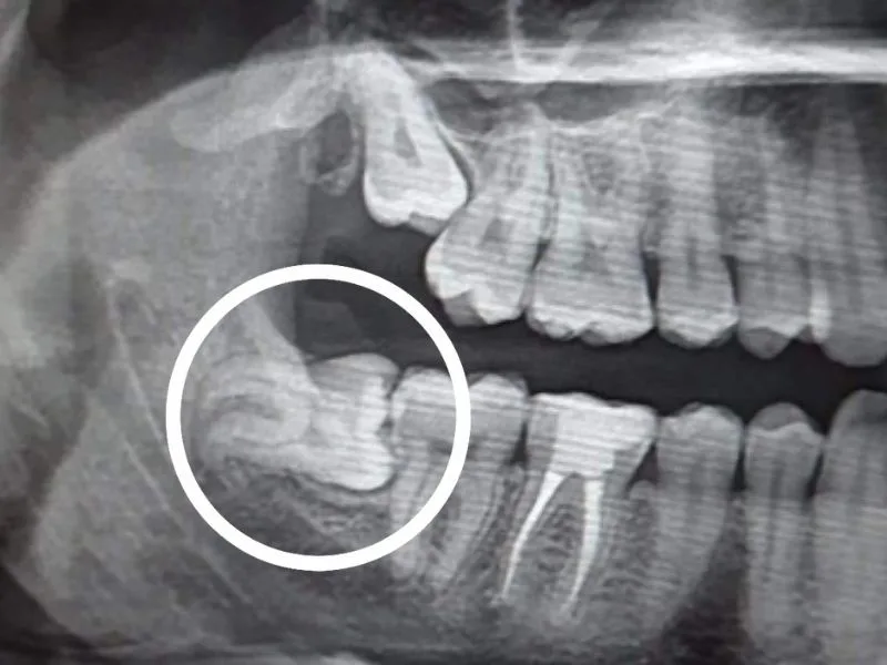 Oral Surgeon in Bandra