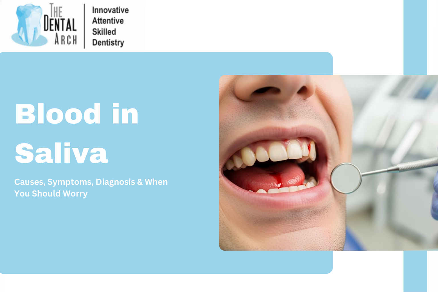 Reasons for Spitting Blood