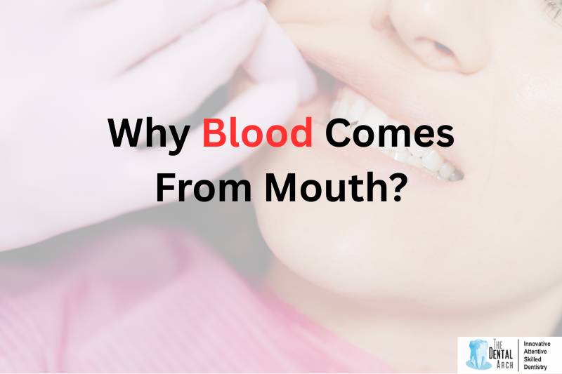 Why Blood Comes From Mouth?