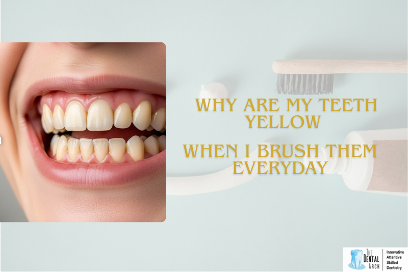 How to Cure Sensitive Teeth (5)