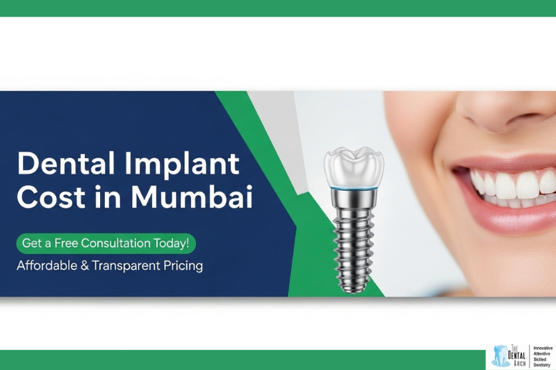 Dental Implant Cost in Mumbai