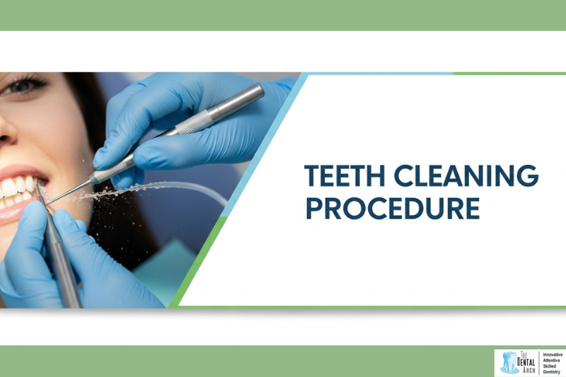 Teeth Cleaning Procedure