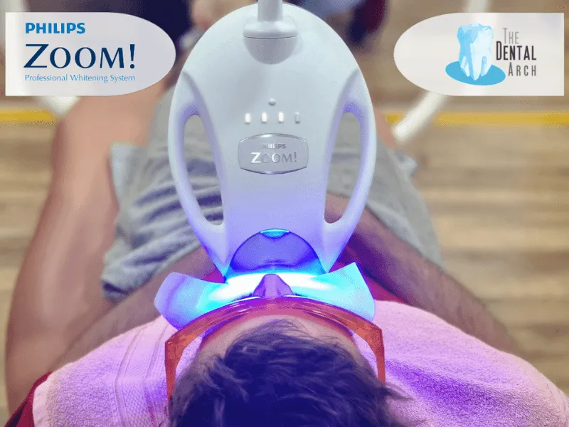 Zoom teeth whitening in Bandra