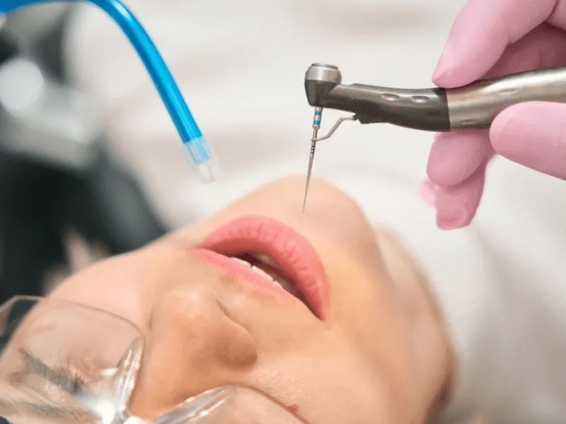 Happy patient of The dental arch, doing root canal treatment