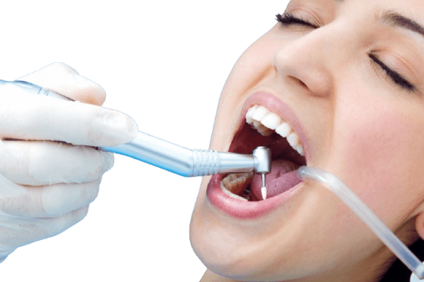 Minimal reshaping of teeth