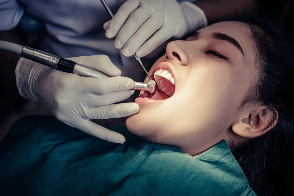 Root Canal Treatment in Bandra.