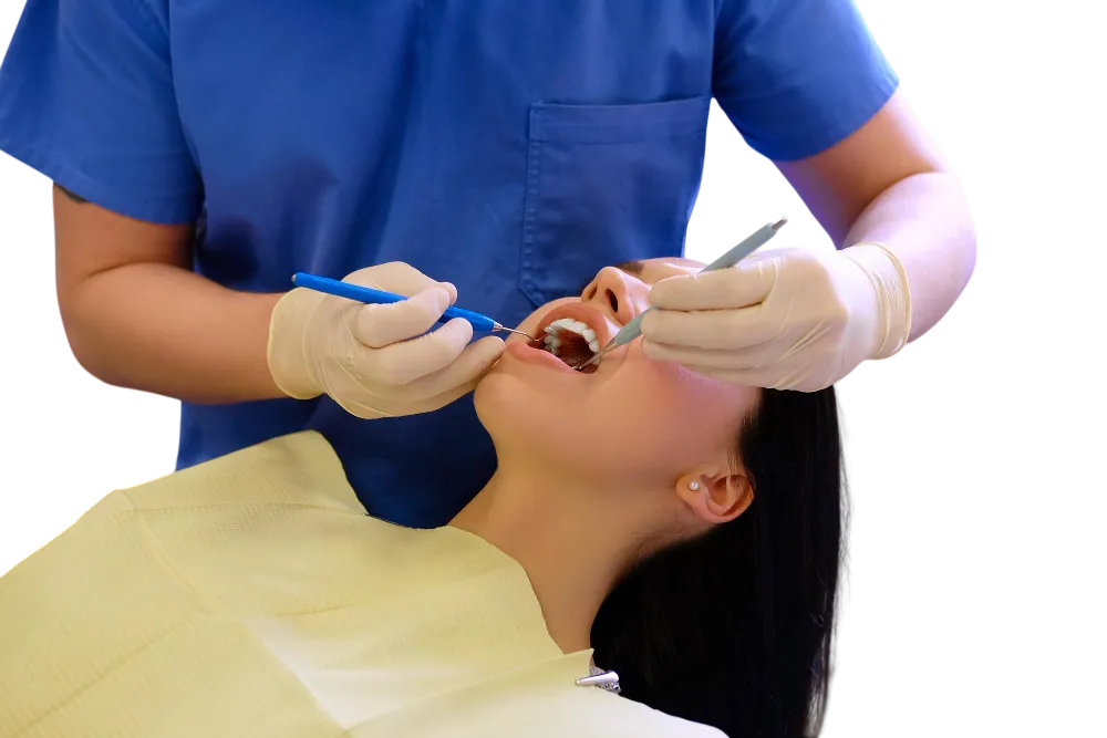 Step 4 Filling & Sealing in root canal