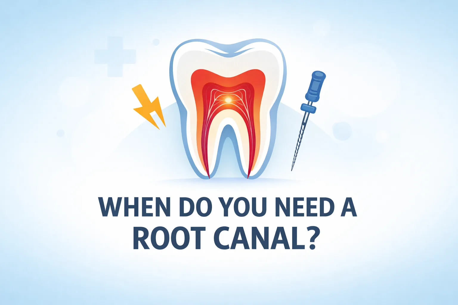 When Do You Need a Root Canal