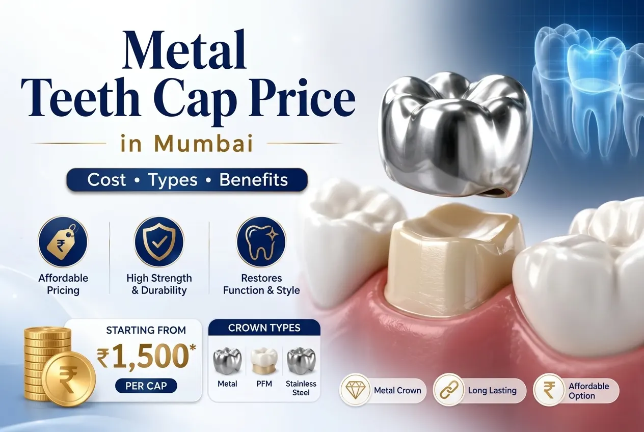 Metal teeth cap price
