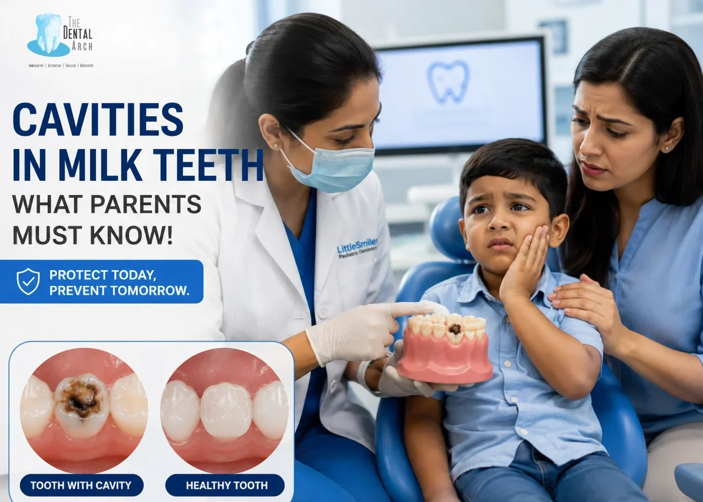 Why Cavities in Milk Teeth Matter
