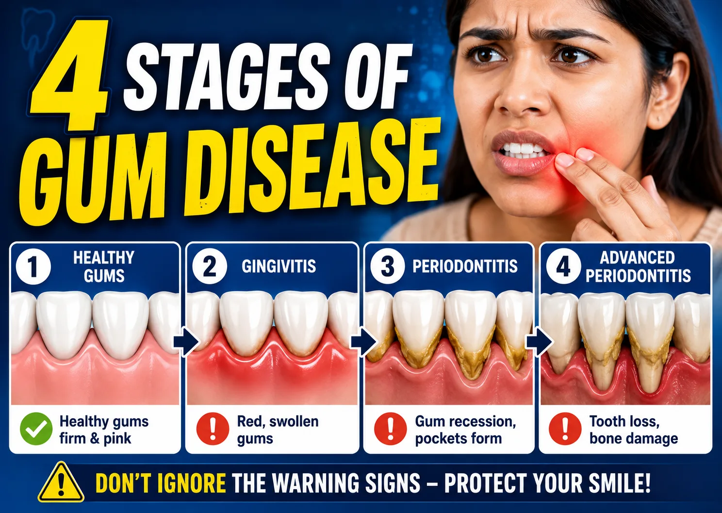 Stages of gum disease