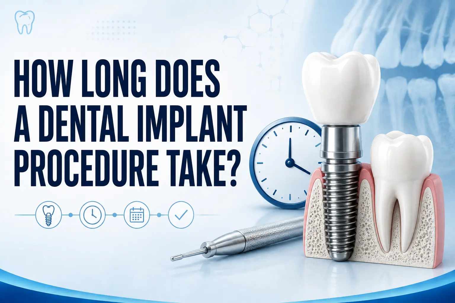 how long does a dental implant procedure take​