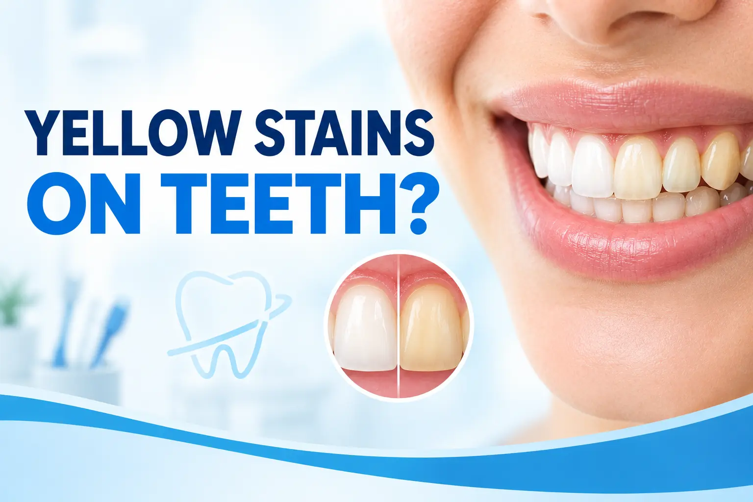 Yellow stains on teeth